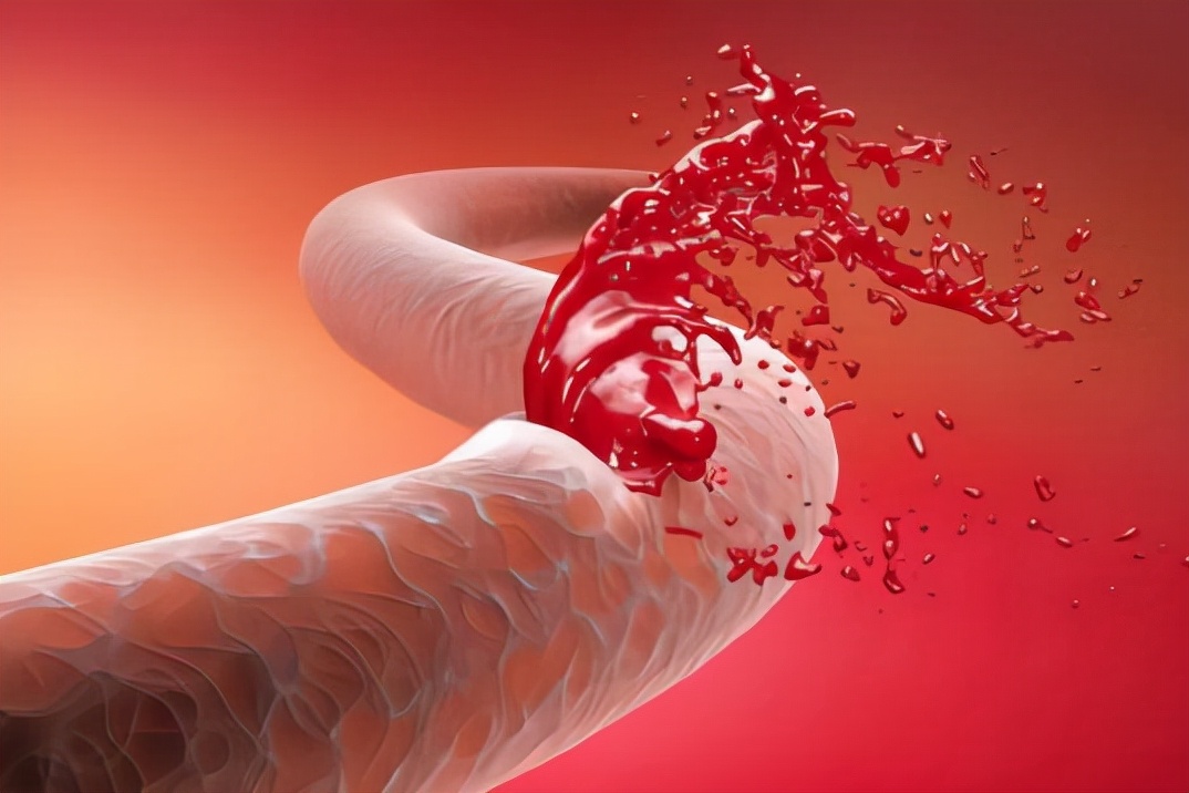 习惯便秘的人，如何摆脱“通便药物的成瘾”，听医生怎么说