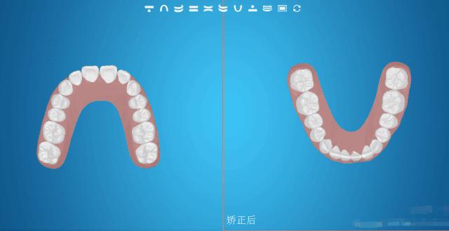 让口红不沾杯不掉色神器,口红防掉色神器