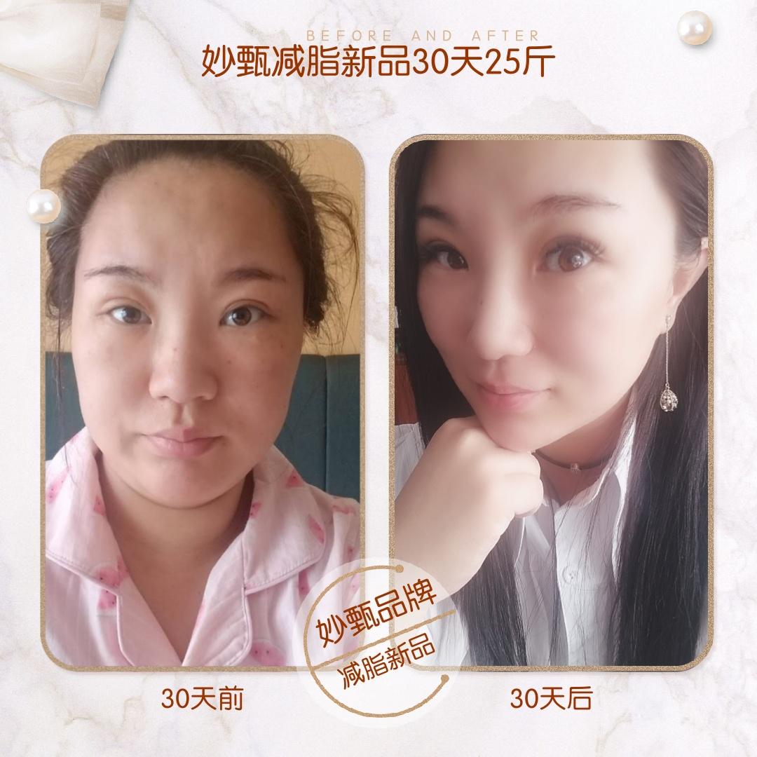 妙甄怎么用效果最好,妙甄品牌视频