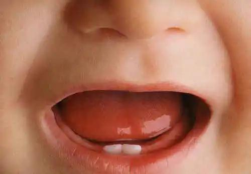 宝宝缺钙牙齿会长得慢吗,长得慢是缺钙吗