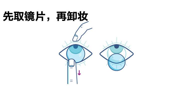 换隐形护理液的时候注意什么,隐形护理液最佳配方