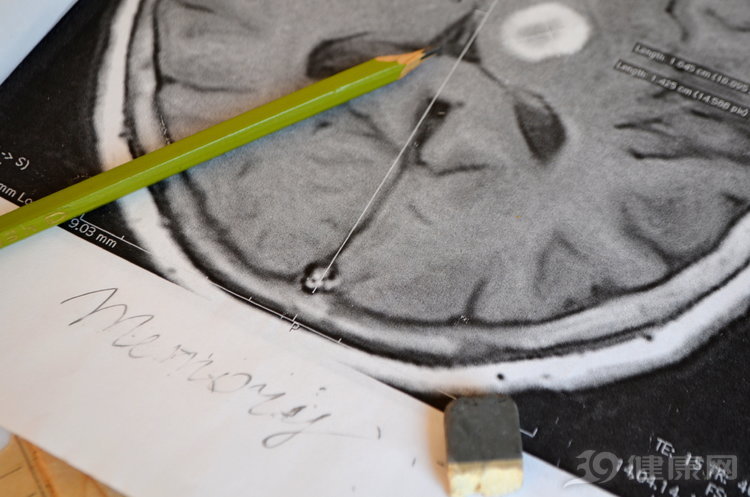 高血压久拖不治，3种并发症会“如约而至”，别小看