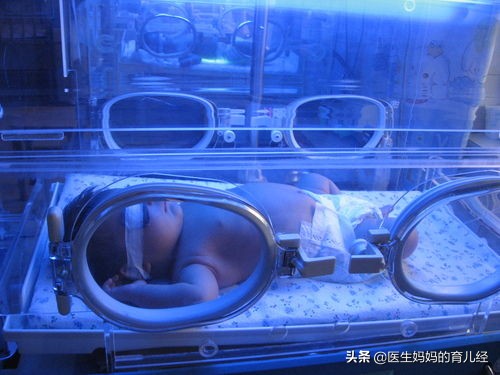 宝宝常见疾病及处理方法,宝宝的十个常见疾病