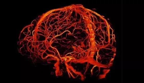 磁共振成像的最新研究,目前最先进的核磁共振仪