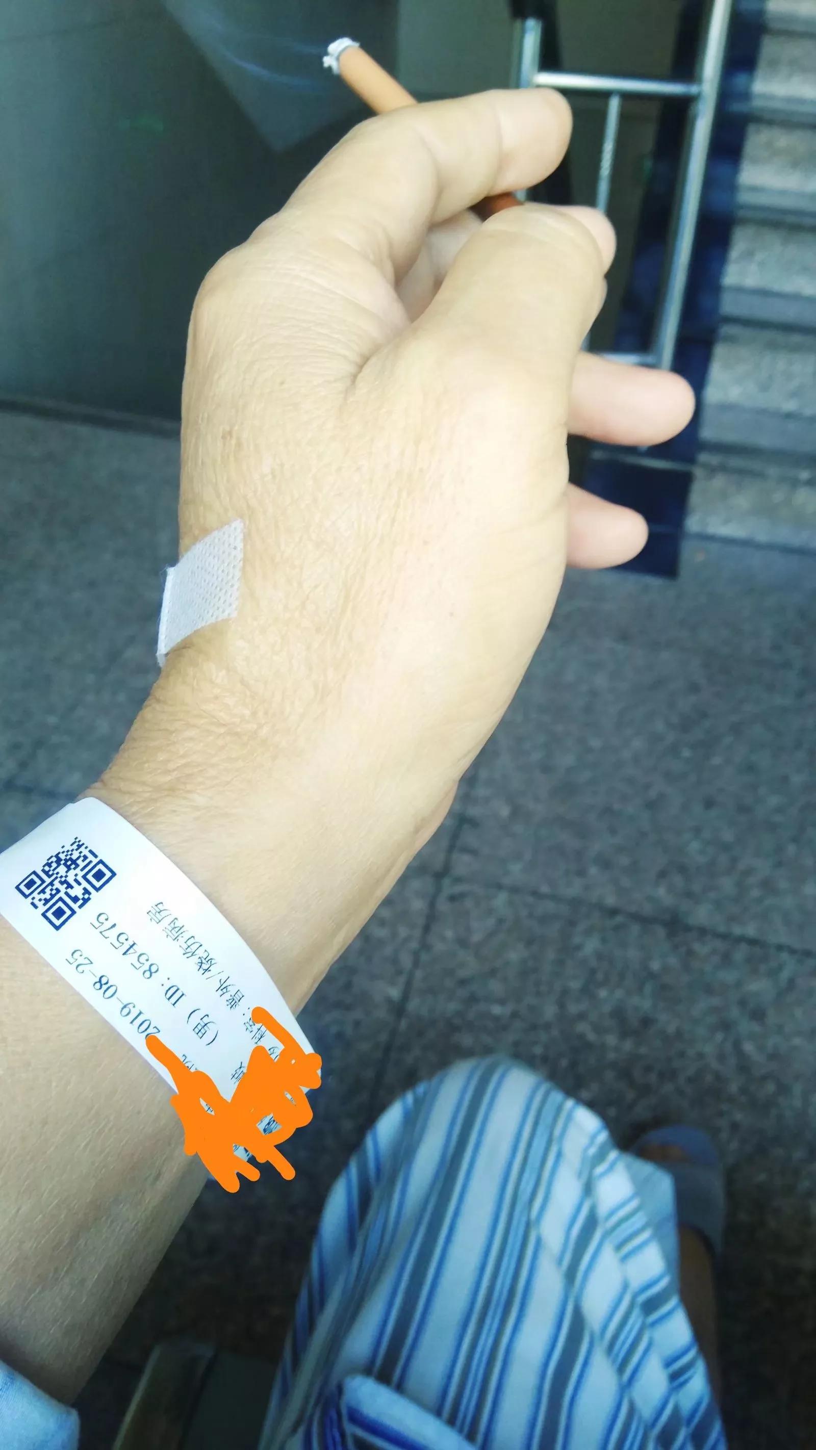 肛瘘手术后15天亲身经历,北京二龙路医院肛瘘手术经历