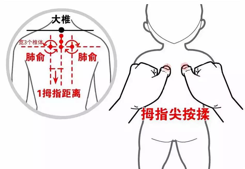 小儿咳嗽雾化用药配方,咳嗽有痰雾化好还是推拿好