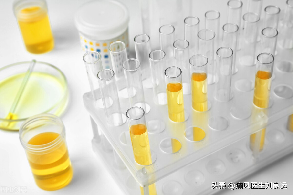 痛风患者查尿酸前能不能吃药,患了痛风到医院要做哪些检查