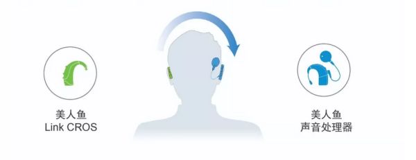 人工耳蜗是最后的办法了吗,人工耳蜗永远不能跟正常人一样