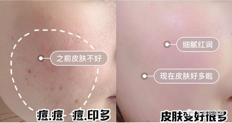 推荐三款好用的洗面奶品牌,洗面奶到底哪款好用又实惠