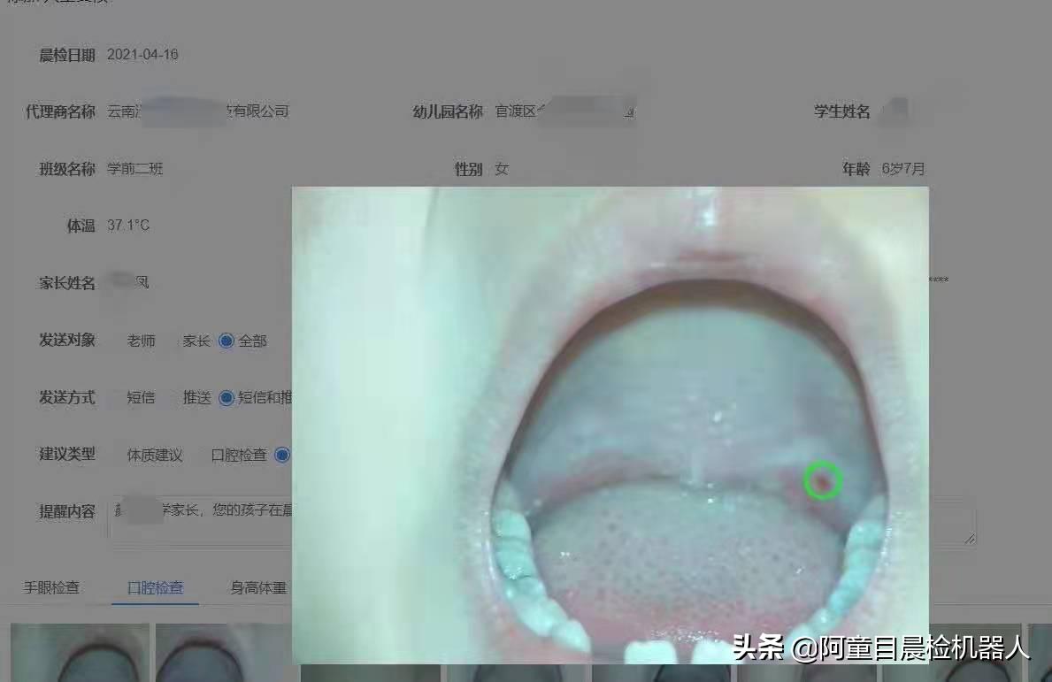 幼儿晨检口腔检查注意事项,阿童目智能晨检机器人晨检功能
