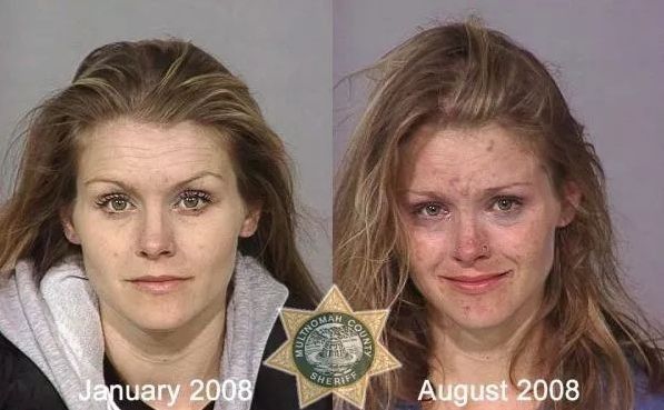 触目惊心吸毒前后真实的对比,吸毒前后可怕容貌变化