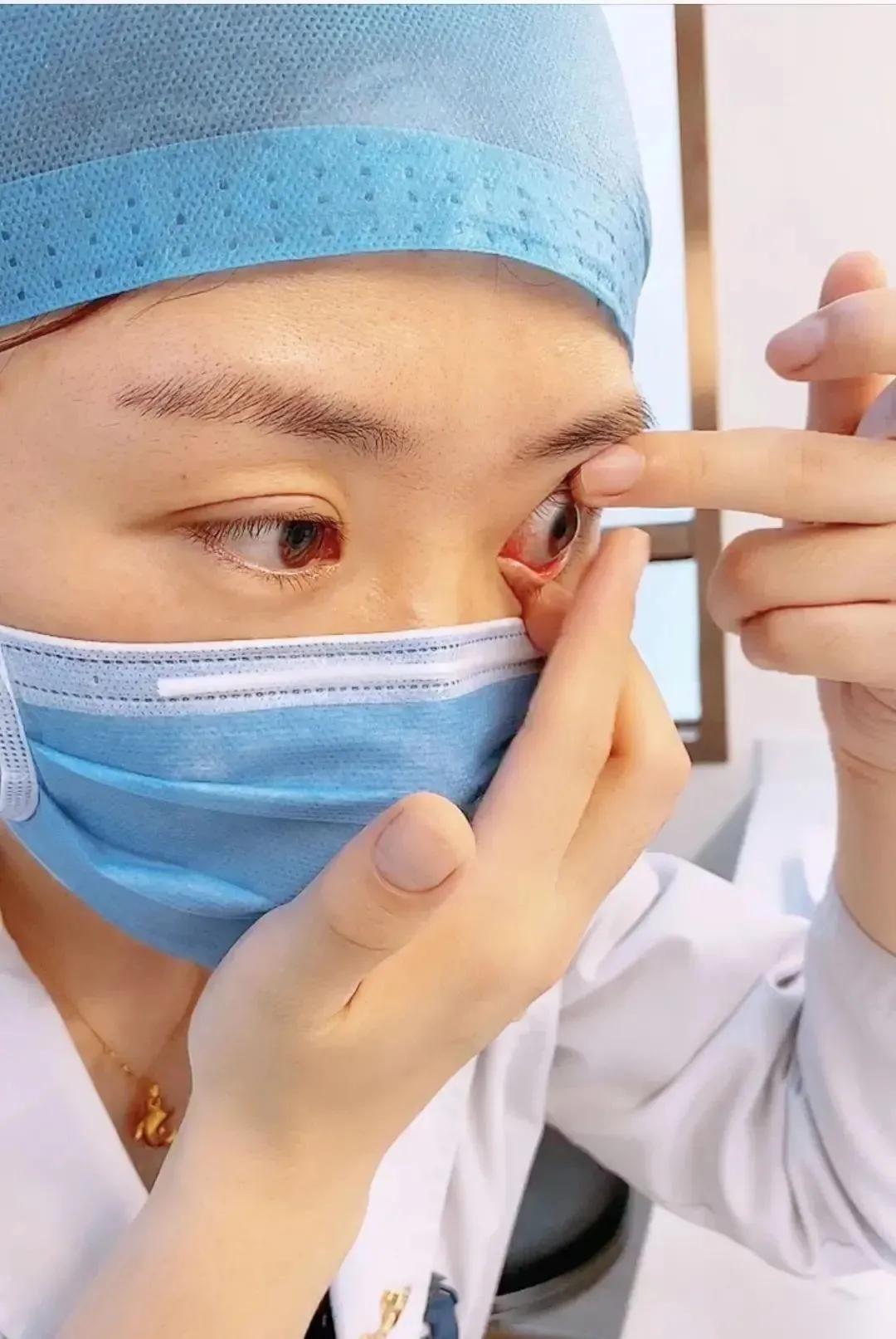 眼科医生隐形眼镜怎么摘取,隐形眼镜怎么摘新手