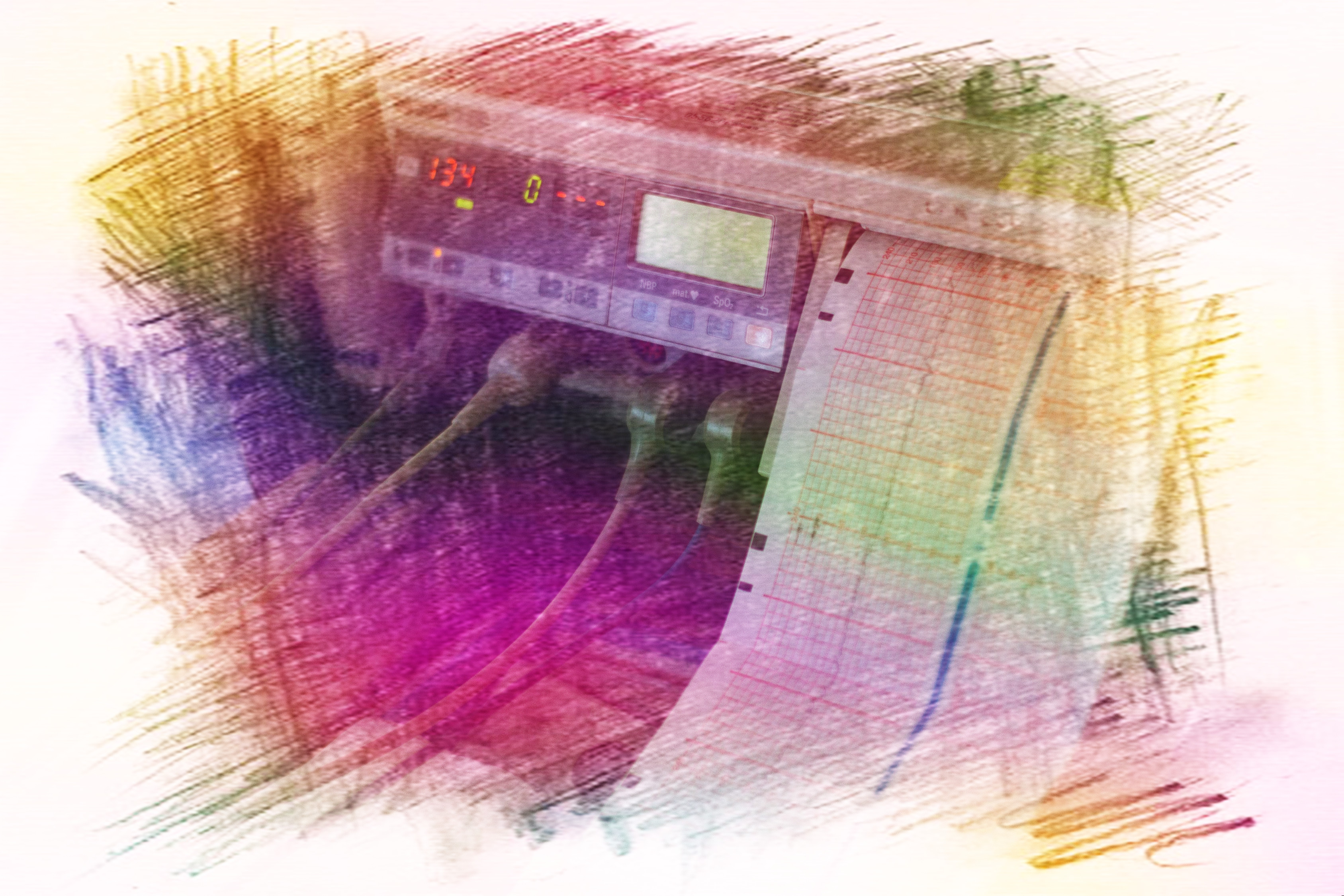 怎样消除测血压紧张焦虑情绪,血压与情绪焦虑紧张有关系吗