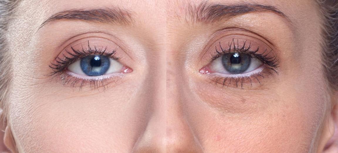 眼霜推荐抗皱去细纹黑眼圈,眼霜推荐去黑眼圈细纹抗皱第一名