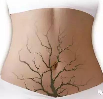 卵巢早衰，人易老！这5种表现都在告诉你：不保护就老了