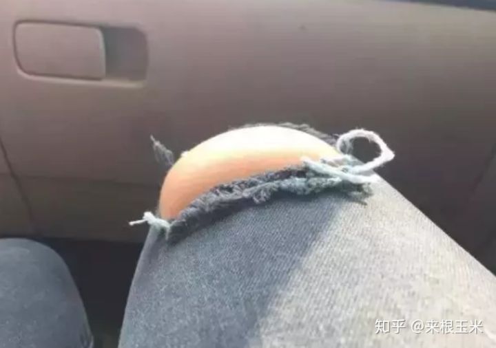 假胯宽、大象腿、脂肪腿，天生大粗腿的人该如何瘦大腿？