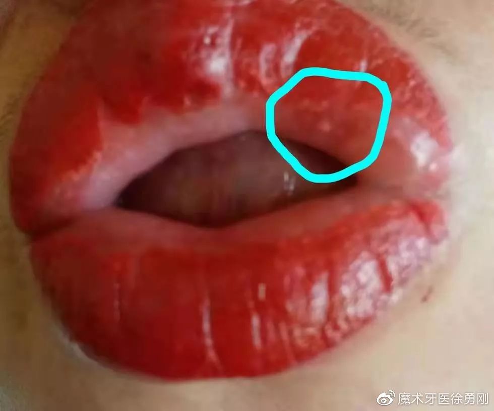 内行人为什么不建议漂唇,作为一名医生一直被人质疑