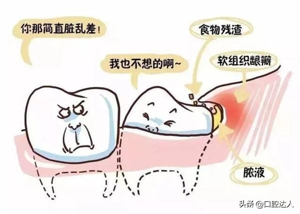 “它”可能给你的长假带来*麻大**烦！医生：早发现，早治疗