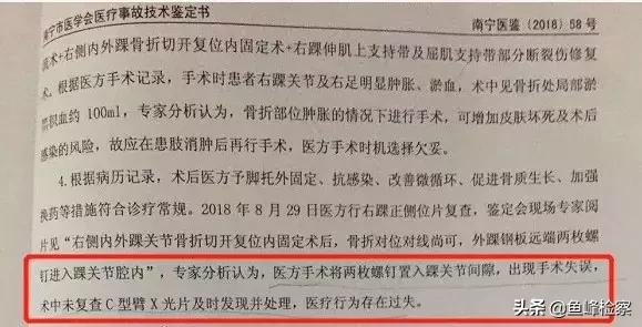 女子骨折术后,骨折术后复查发现钢钉有错位