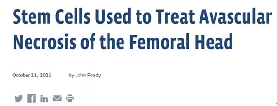 股骨头坏死干细胞移植手术能好吗,干细胞可以治疗股骨头坏死吗