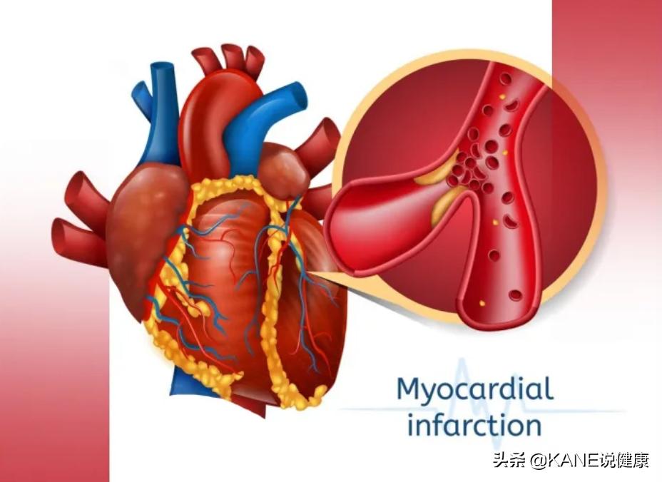 血液净化能控制血栓吗,血液净化真的能排油吗