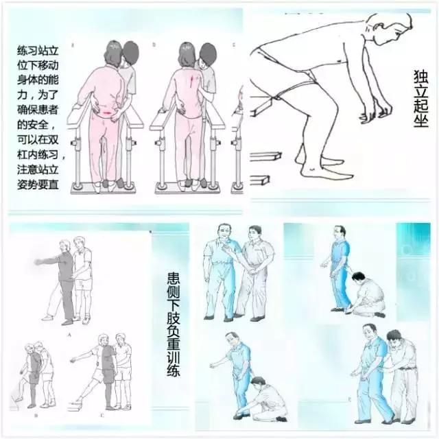 医生详细图文演示：脑卒中患者各阶段康复治疗方案，建议收藏！