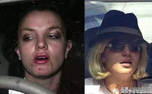 吸毒的人的特征图片,如何用眼睛判断识别别人是否吸毒