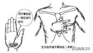 马拉松跑者两次晕倒后继续跑步!医生的忠告您一定要听!