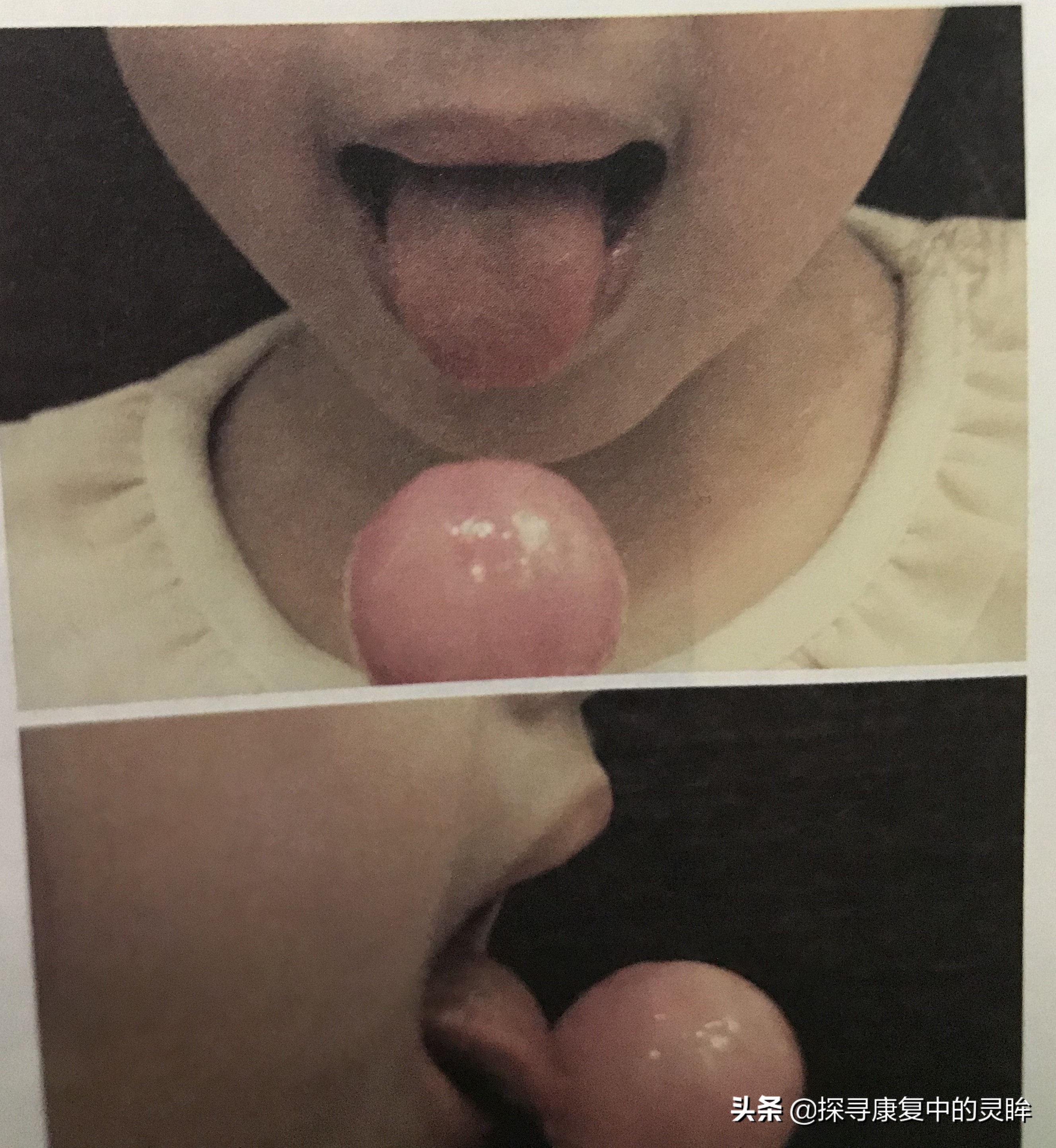 五种口部运动:灵活孩子的樱桃小嘴,让他们说话更清晰(超简单)