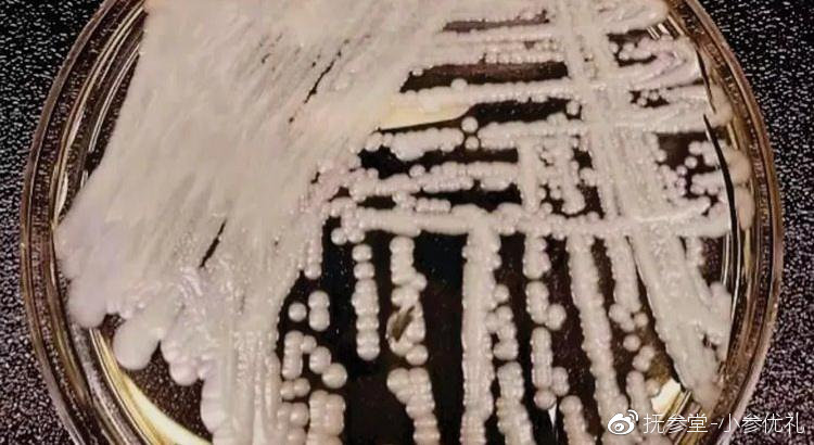 超级真菌究竟是什么,别被忽悠了这六类病根本不用治