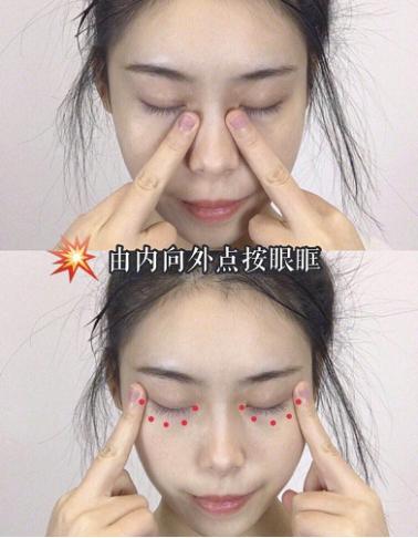 熊猫眼黑眼圈怎么去除,熊猫眼去黑眼圈需要几次有效果