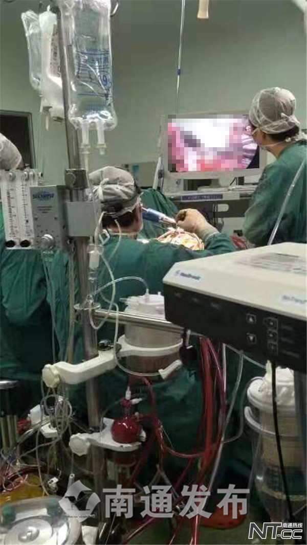 眼科迎来就诊高峰,医院迎来一波就诊高峰