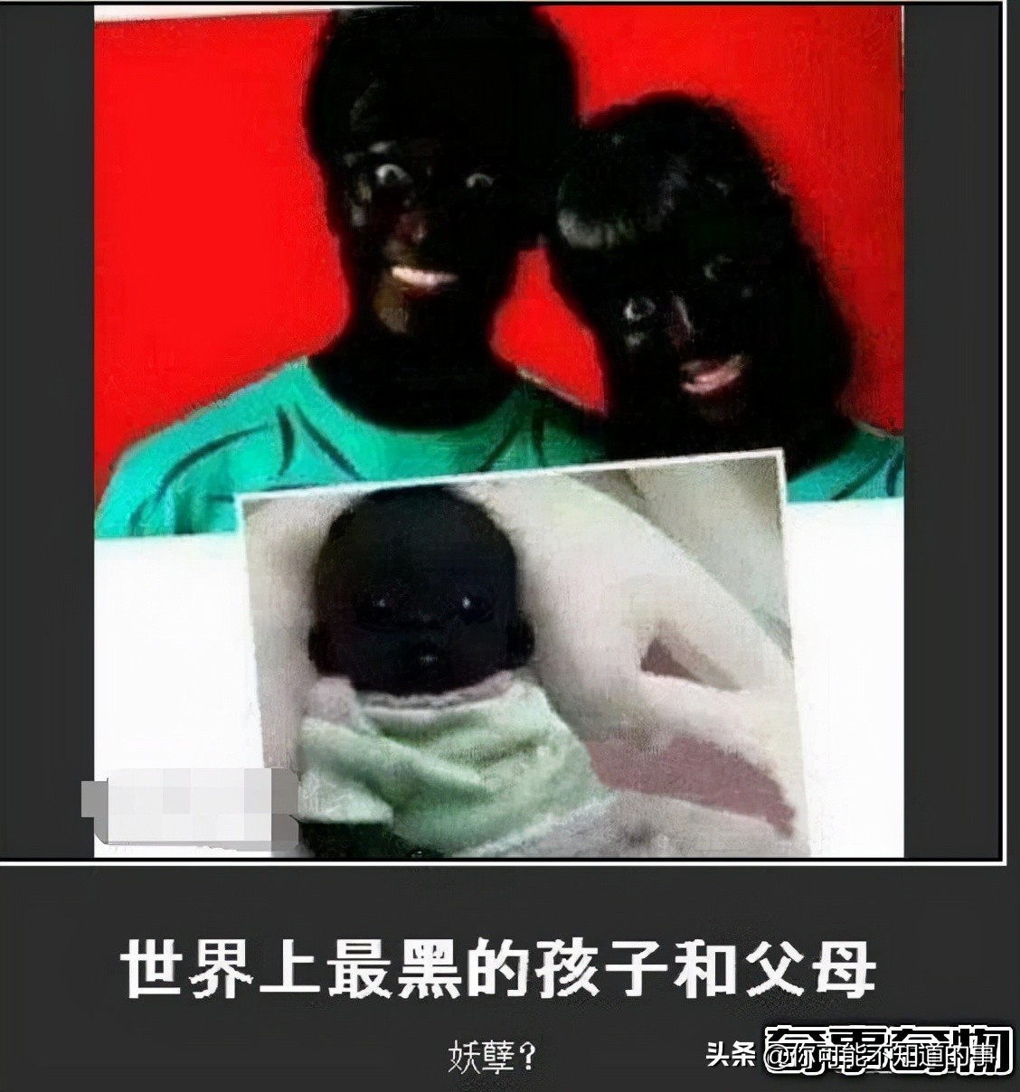 世界上最黑的小孩眼睛,世界上最黑的小孩来自哪里