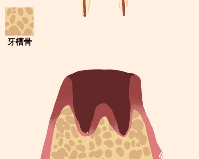 一颗牙齿的动画图片,牙齿脱落过程图解
