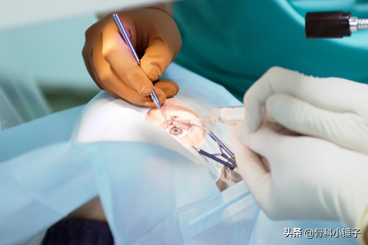 坐骨神经痛该怎么解决,坐骨神经痛该怎么锻炼恢复