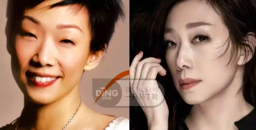 中庭又长又宽显老,中庭长怎么避免显老