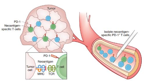 怀疑骨结核怎么排除,怀疑是结核怎样免费检查
