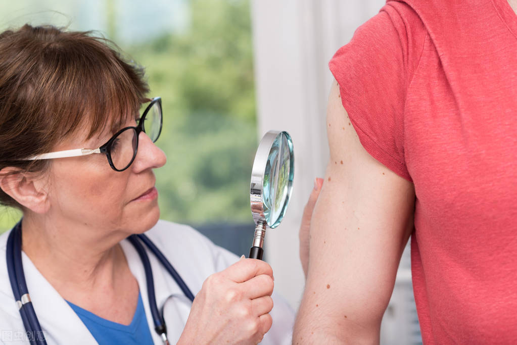 银屑病要做什么检查才确诊,银屑病关节炎检查哪几项可以确诊