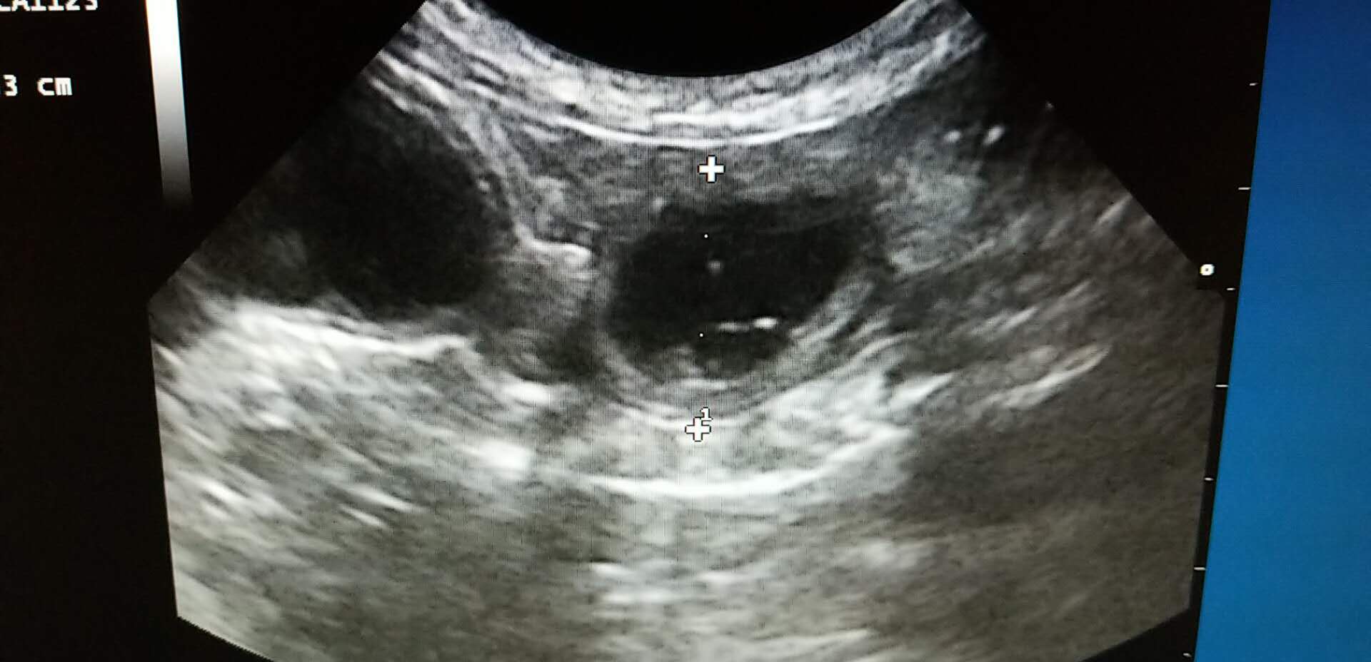 猫肠梗阻怎么治,猫肠梗阻的治疗方法