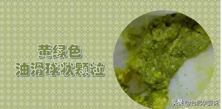 小宝宝拉绿屎怎么了,老话说宝宝拉绿屎怎么说