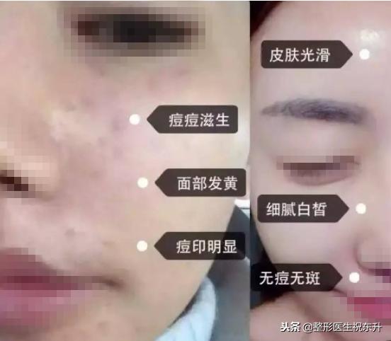 90%的皮肤问题都是缺水导致的,每天8杯水补水