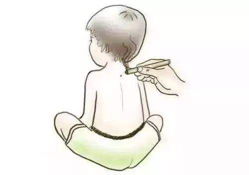 艾灸馆艾灸理疗师工作日常,儿童艾灸最佳时间和禁忌