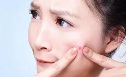 青春期的痘痘要不要治,别瞎治了痘痘的治疗原则是这4点