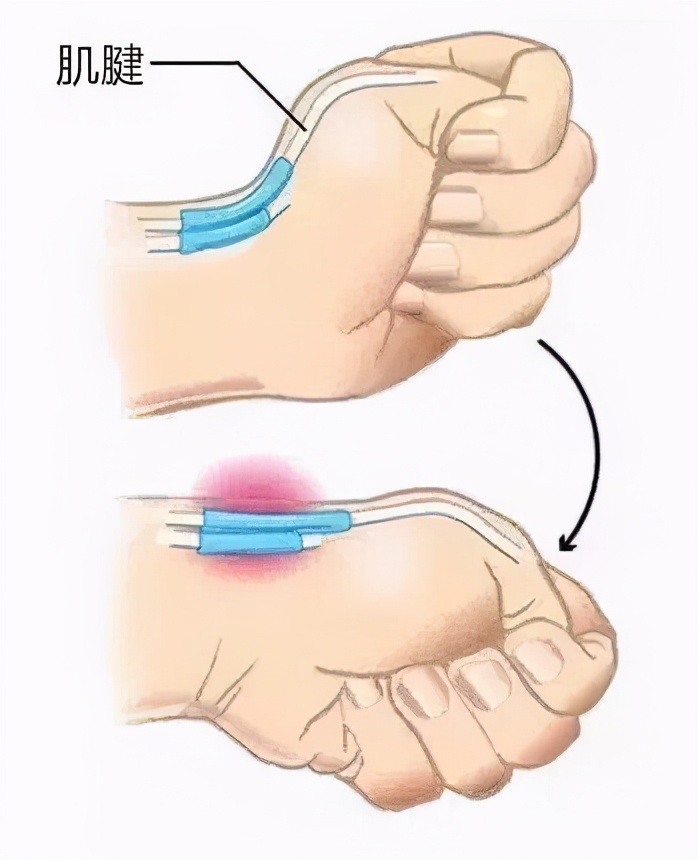 生孩子后容易衰老的特征,为何女性产后衰老那么快