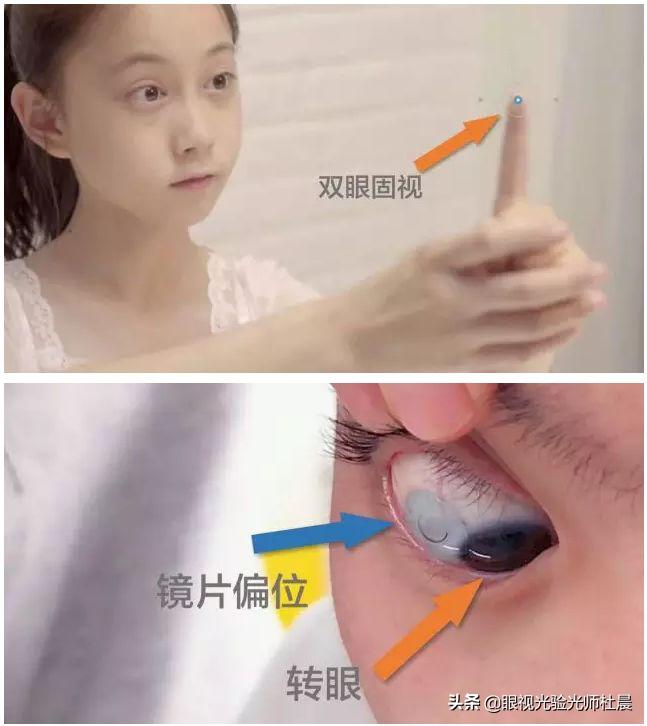 初次戴隐形眼镜的技巧,戴隐形眼镜眼睛注意事项