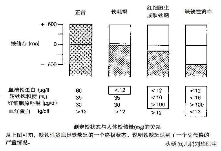 用铁锅炒菜可有效预防缺铁性贫血,儿童营养性缺铁性贫血的干预措施