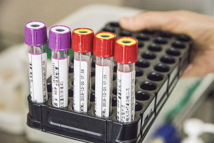 医生,我的检查结果为什么不能用?