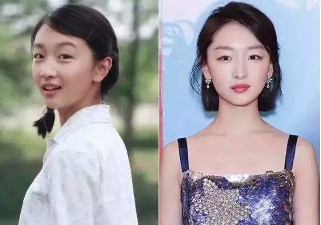 平价淡斑美白小灯泡,神仙水小灯泡精华淡斑