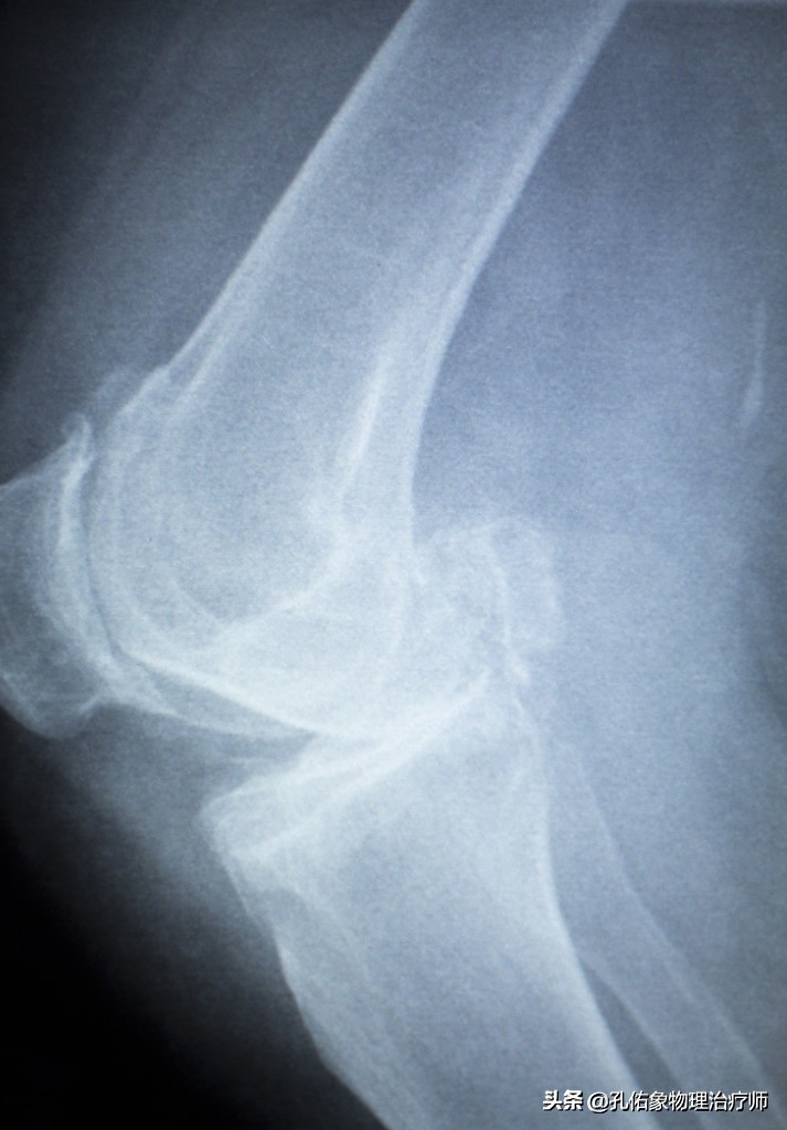 膝关节疼痛需不需要重视,膝盖疼痛不要忍