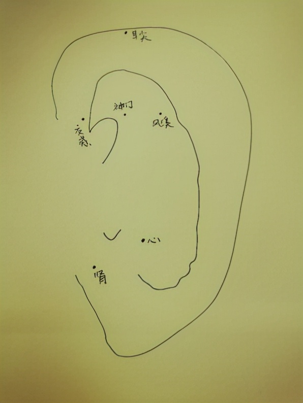 “肛”湖问道|动动小耳朵,身体百病消